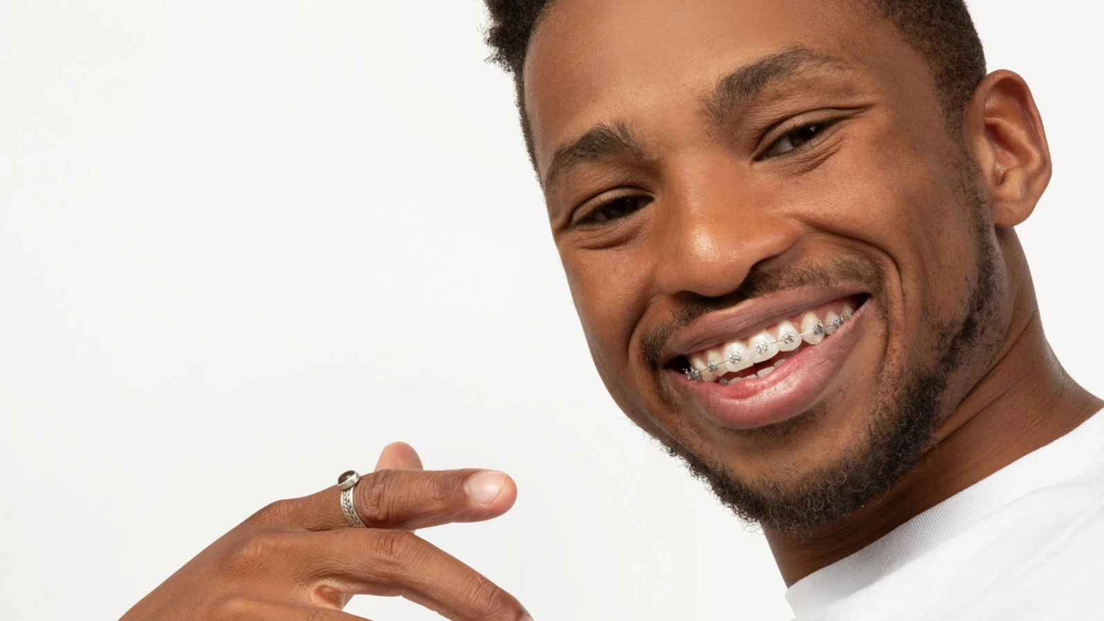 An adult with braces smiling at Medland Orthodontics An adult with braces smiling at Medland Orthodontics