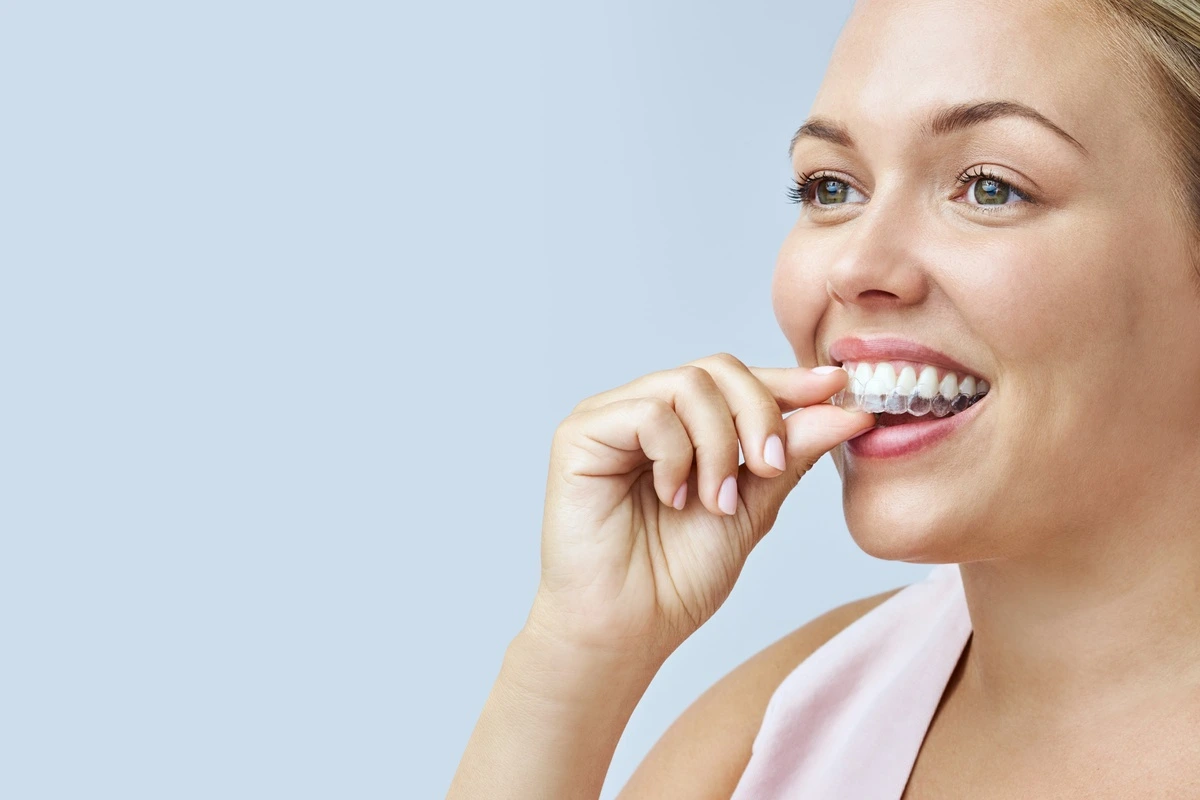 Invisalign clear aligners for adults