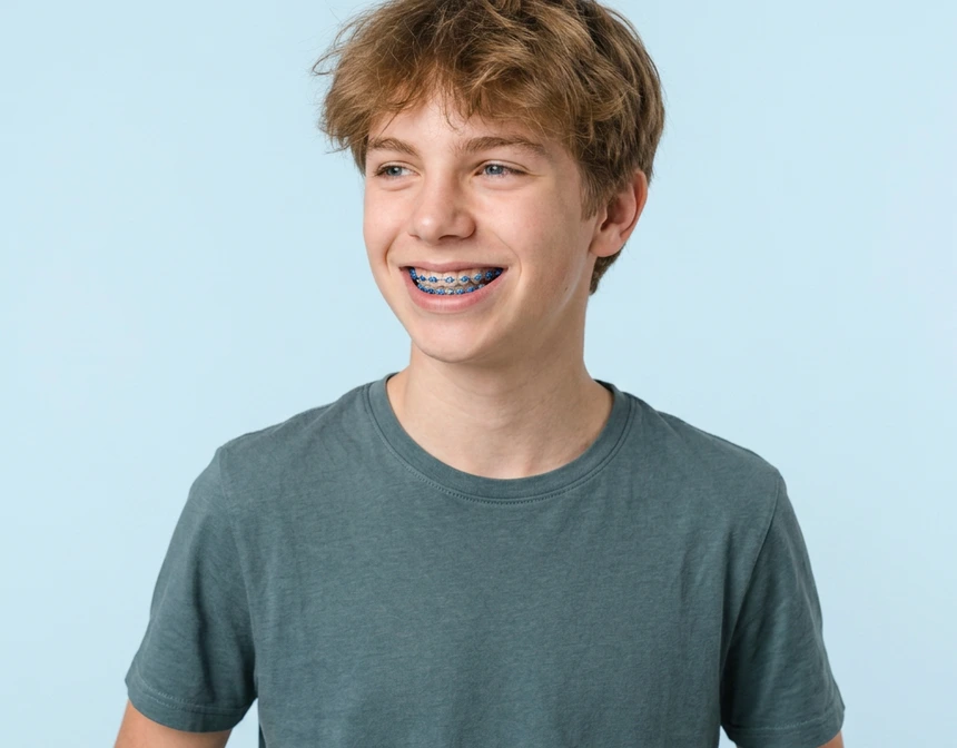 Braces for children Braces for children