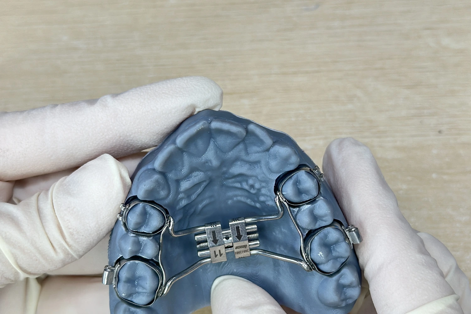 Child smiling during expander treatment