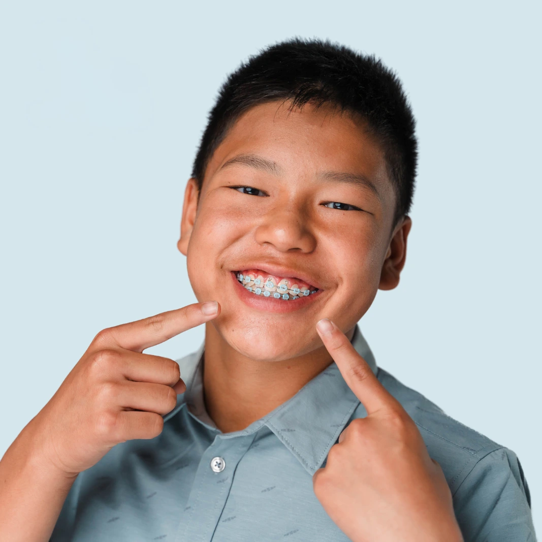 A child with braces smiling at Medland Orthodontics A child with braces smiling at Medland Orthodontics